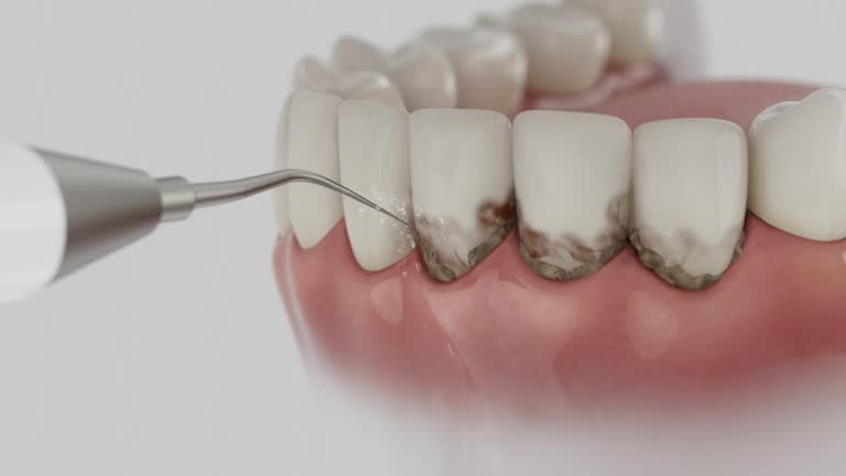 Trusted Teeth Cleaning And Checkup service in Center Hill, FL - Dentist Open Now